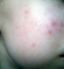 attached-photo