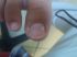 attached-photo