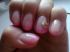 attached-photo