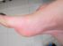 attached-photo