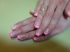 attached-photo