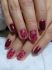 attached-photo