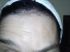 attached-photo