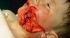 attached-photo