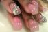 attached-photo