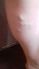attached-photo