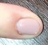 attached-photo