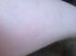 attached-photo